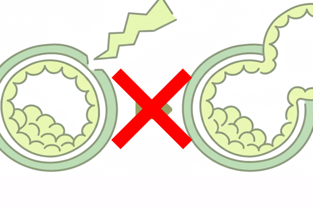 アシステッドハッチング意味ないって本当？｜現役胚培養士が明かす本当の効果と必要な人の特徴｜成功率UPの真実｜不妊治療なら生殖医療クリニック錦糸町駅前院