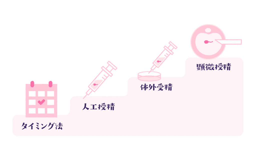 不妊治療のステップ